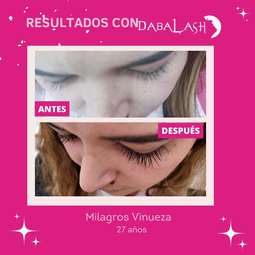 Testimonios de crecimiento de pesta&ntilde;as 